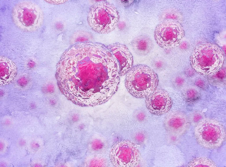 台州糖尿病幹細胞功效及治療實例分析。