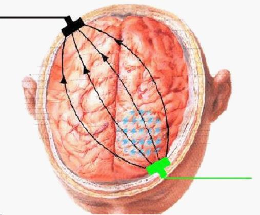 引發外傷性癫痫的原因是什麽？文章這幾點提醒你怎樣預防外傷性癫痫