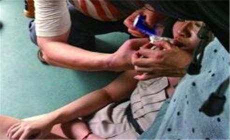 如何預防癫痫病？癫痫病的早期症狀有什麽？