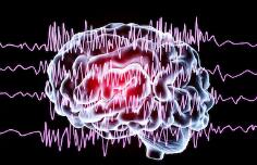 怎麽檢查癫痫呢？該怎麽診斷是癫痫病呢？