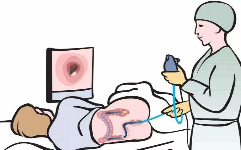 肛部尖銳濕疣患者有什麽治療方法？需要進行哪些檢查