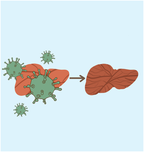 複方鼈甲軟肝片可以一直吃嗎？吃多久有效？