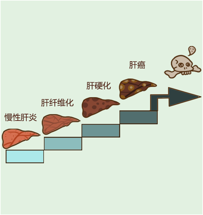 早期肝硬化可以吃軟肝片嗎？選對藥自己才舒服