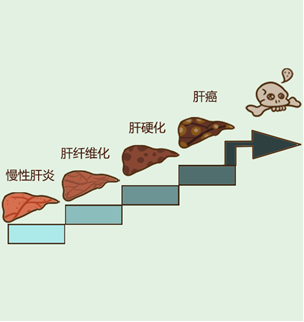 軟肝吃什麽中成藥？生活上要做好什麽？