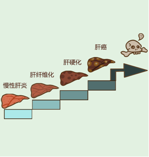 軟肝吃哪種藥有用？可以治療肝硬化嗎？