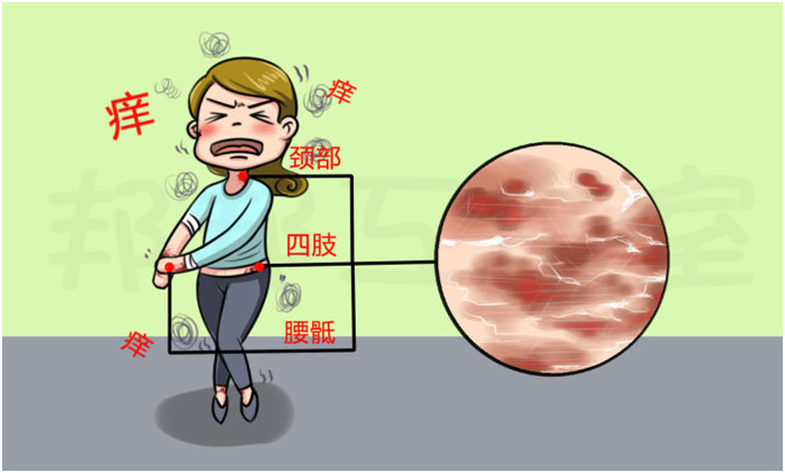 神經性皮炎會導緻細胞增生嗎？答案就在文中