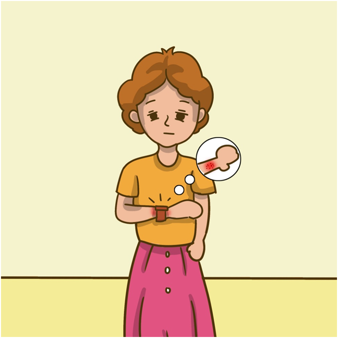 過敏性皮炎分幾個階段？這三個階段要記清