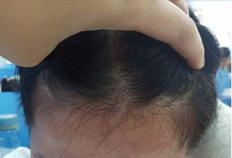 用什麽洗頭可以生發？小心别入坑