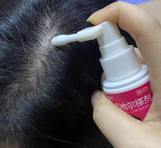 經常脫發怎麽辦?找對了方法,頭發不就長回來了!