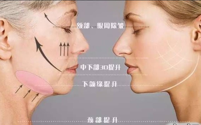 【活動回顧】重慶聯合麗格小V臉之新品發布周年慶專場分享會