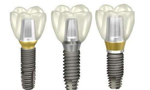 北京種植牙哪家醫院好？健福、北區、笑研不同區的佼佼者速來看