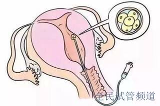 北京知名私立試管醫院排名，這些機構上榜了