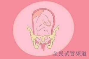 挑選泰國試管醫院要點，優質服務是關鍵