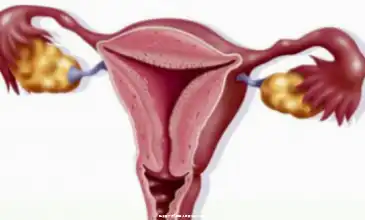 性激素六項1,哪些人需要定期檢查? 性激素六項1,哪些人需要定期檢查?