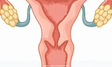可視清宮手術全過程多少錢,術後恢複需要注意哪些事項？