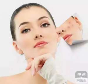 臉部白癜風的發病症狀 臉部白癜風護理