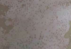 白癜風哪裏能治