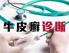 頭部牛皮癬診斷的要點是什麽