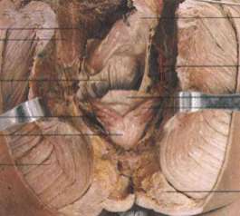 引發男人慢性前列腺炎的病因是什麽