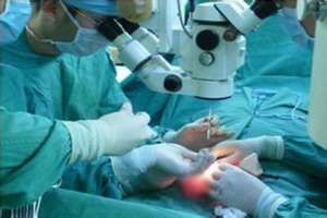 如何預防雙側靜脈曲張