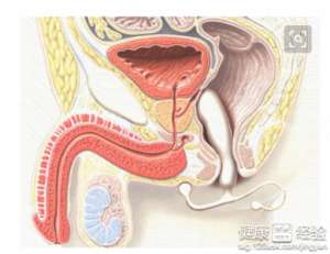 細菌前列腺可以治好嗎常見治療方案有六種