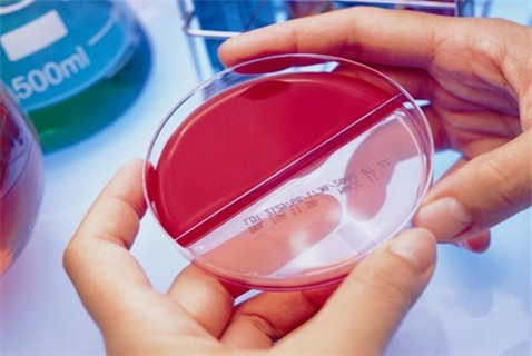 診治龜頭炎有哪些方法