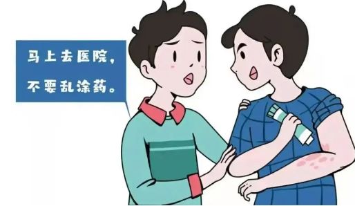 濟南銀屑病醫院排名〝今日熱搜〞鍛煉可以預防銀屑病嗎