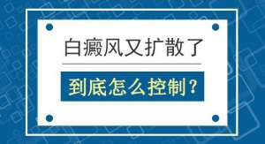 精選:南昌白癜風醫院排行榜，男性白癜風預防方法究竟是什麽方面？